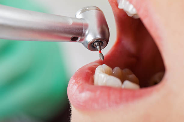 Best Emergency Treatment for Oral Infections in Wolfhurst, OH